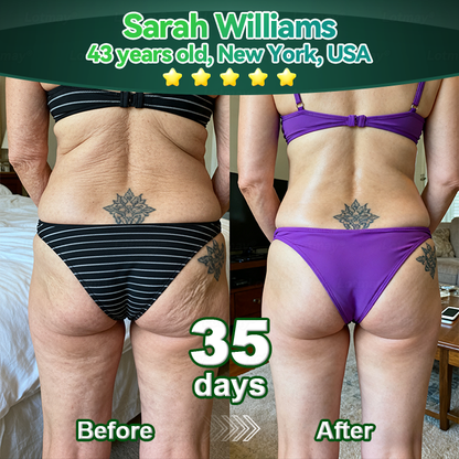 Change from the inside out 👨‍⚕️ 𝐿𝑜𝑡𝑚𝑎𝑦® 𝑆𝑡𝑒𝑚 𝐶𝑒𝑙𝑙 & 𝐶𝑜𝑙𝑙𝑎𝑔𝑒𝑛 𝑃𝑒𝑝𝑡𝑖𝑑𝑒 𝑂𝑟𝑎𝑙 𝐷𝑟𝑜𝑝𝑠 (Lift & Firm Sagging Skin & Reduce Wrinkle Formation)