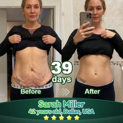 Change from the inside out 👨‍⚕️ 𝐿𝑜𝑡𝑚𝑎𝑦® 𝑆𝑡𝑒𝑚 𝐶𝑒𝑙𝑙 & 𝐶𝑜𝑙𝑙𝑎𝑔𝑒𝑛 𝑃𝑒𝑝𝑡𝑖𝑑𝑒 𝑂𝑟𝑎𝑙 𝐷𝑟𝑜𝑝𝑠 (Lift & Firm Sagging Skin & Reduce Wrinkle Formation)