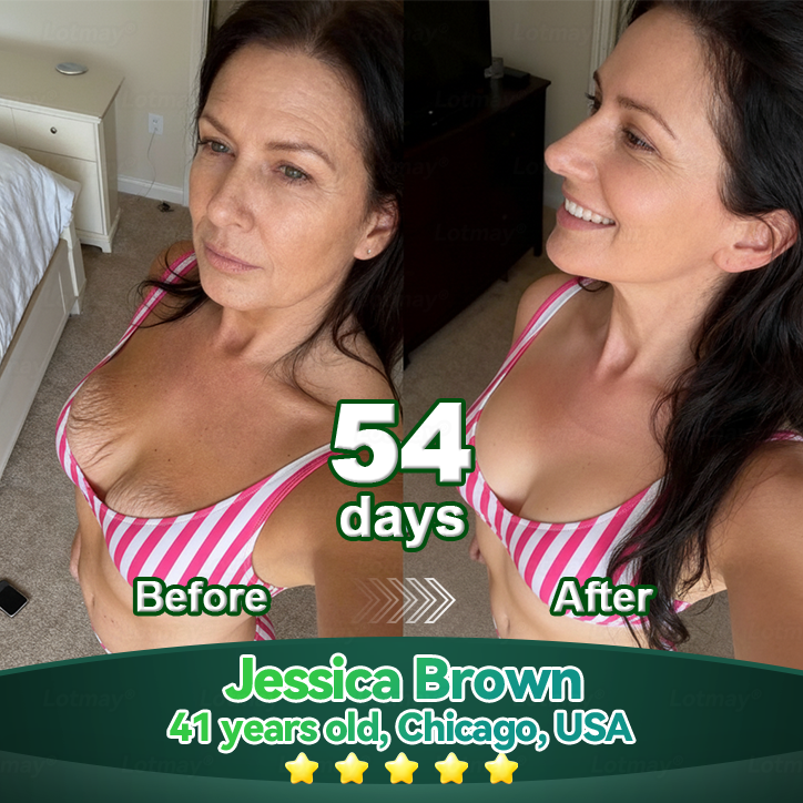 Change from the inside out 👨‍⚕️ 𝐿𝑜𝑡𝑚𝑎𝑦® 𝑆𝑡𝑒𝑚 𝐶𝑒𝑙𝑙 & 𝐶𝑜𝑙𝑙𝑎𝑔𝑒𝑛 𝑃𝑒𝑝𝑡𝑖𝑑𝑒 𝑂𝑟𝑎𝑙 𝐷𝑟𝑜𝑝𝑠 (Lift & Firm Sagging Skin & Reduce Wrinkle Formation)