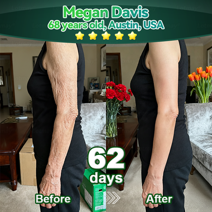 Change from the inside out 👨‍⚕️ 𝐿𝑜𝑡𝑚𝑎𝑦® 𝑆𝑡𝑒𝑚 𝐶𝑒𝑙𝑙 & 𝐶𝑜𝑙𝑙𝑎𝑔𝑒𝑛 𝑃𝑒𝑝𝑡𝑖𝑑𝑒 𝑂𝑟𝑎𝑙 𝐷𝑟𝑜𝑝𝑠 (Lift & Firm Sagging Skin & Reduce Wrinkle Formation)