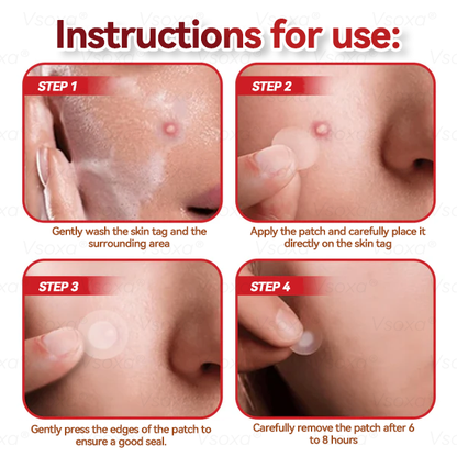 𝑉𝑠𝑜𝑥𝑎® 💧Microneedles Botanical Skin Tags Solution Patches - Made in the USA👩‍⚕️