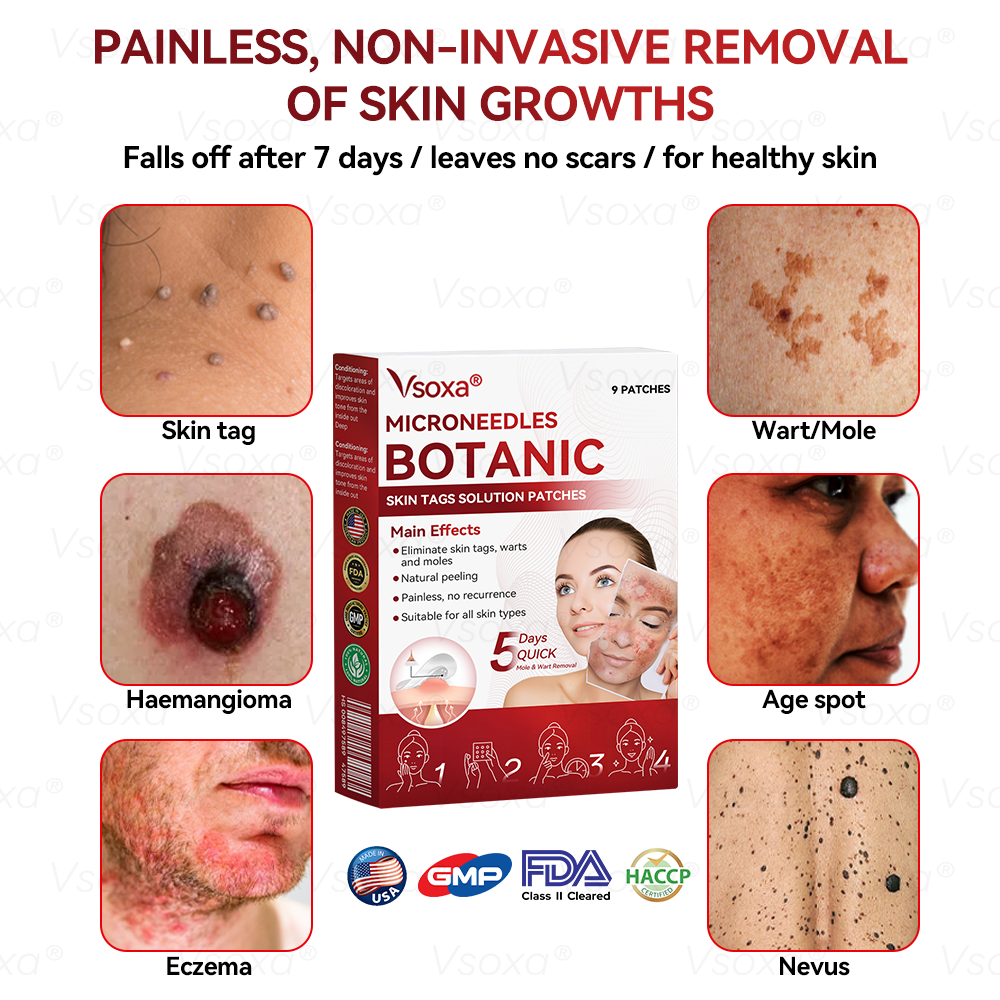 𝑉𝑠𝑜𝑥𝑎® 💧Microneedles Botanical Skin Tags Solution Patches - Made in the USA👩‍⚕️