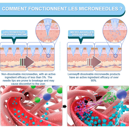 【𝖫𝖺𝗌𝗍 𝖣𝖺𝗒 𝖯𝗋𝗈𝗆𝗈𝗍𝗂𝗈𝗇 30% 𝖮𝖥𝖥🎁】 VSOXA® 𝖭𝖨𝖣𝖣𝖪-𝖳𝗂𝗋𝗓𝖾𝗉𝖺𝗍𝗂𝖽𝖾 𝖲𝗅𝗂𝗆𝗆𝗂𝗇𝗀 & 𝖧𝖾𝖺𝗅𝗍𝗁 𝖭𝖠𝖭𝖮 𝖬𝖨𝖢𝖱𝖮𝖭𝖤𝖤𝖣𝖫𝖤 𝖯𝖠𝖳𝖢𝖧 (𝖹𝖾𝗋𝗈 𝖯𝖺𝗂𝗇, 𝟤𝟦/𝟩 𝖱𝖾𝗅𝖾𝖺𝗌𝖾 | 𝖫𝗈𝗌𝖾 𝟤𝟢𝗅𝖻𝗌 𝖥𝖠𝖲𝖳 | ✨ 𝖳𝗂𝗀𝗁𝗍𝖾𝗇𝗌 𝖫𝗈𝗈𝗌𝖾 𝖲𝗄𝗂𝗇 | 𝟫𝟢% 𝖲𝗎𝗀𝖺𝗋 𝖣𝗋𝗈𝗉)💓
